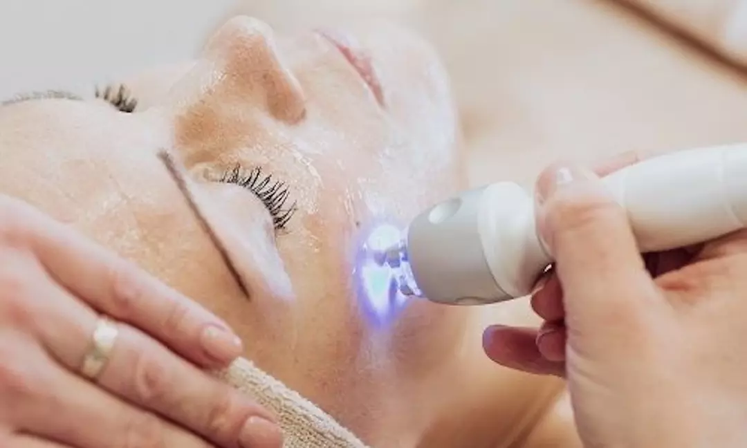Up to 46% Off on HydraFacial at Q Lash & Facial Lounge - Primary Image