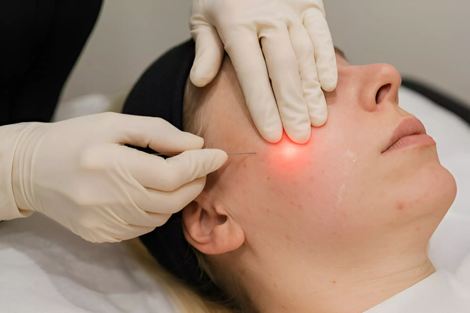 Up to 55% Off on Facelift - Non-Surgical at Leevision Ophthalmology Services