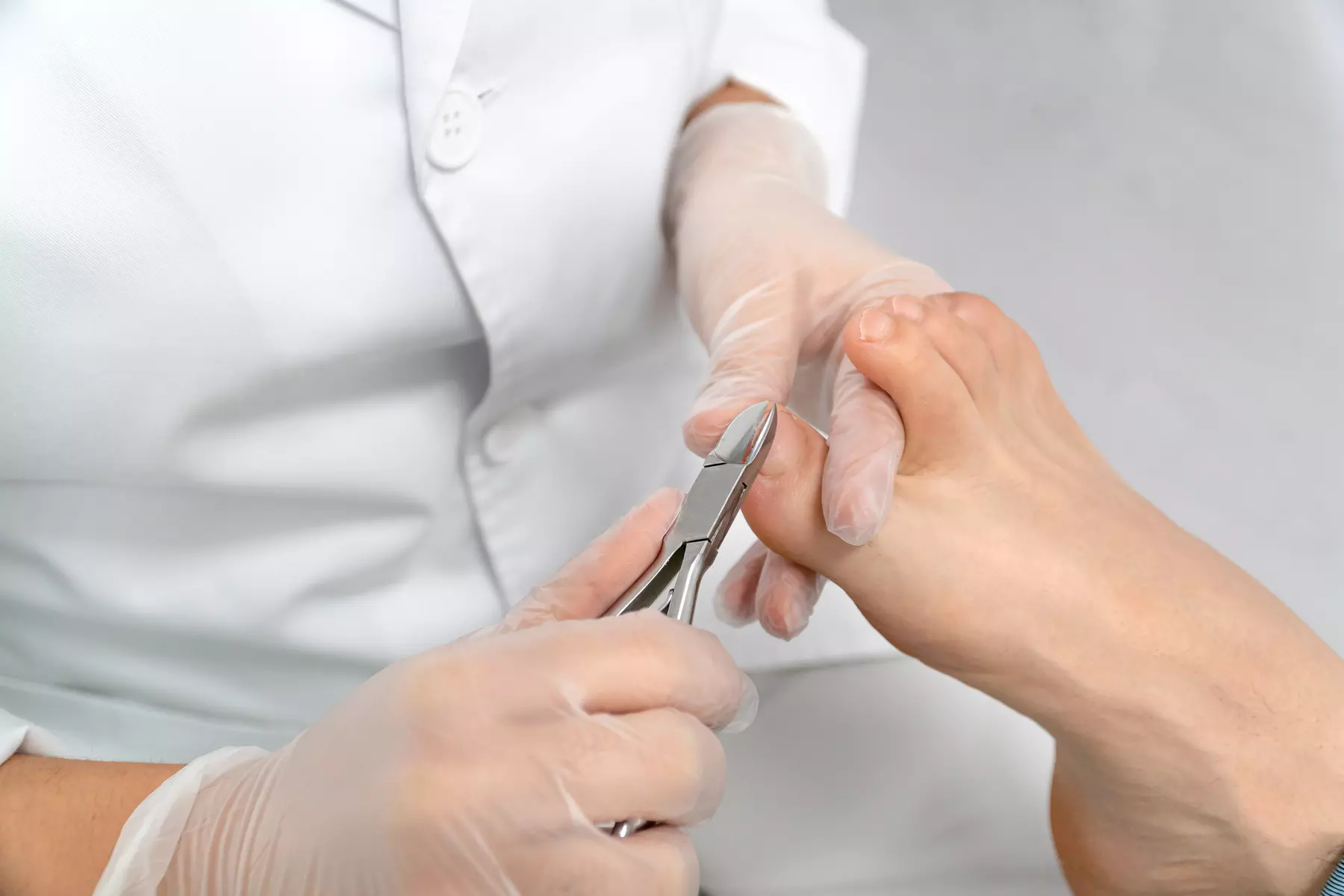 Professional Toenail Cutting & Podiatry Care (Up to 80%)