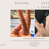 Image 2: Up to 50% Off on Tattoo Removal at Beauty Doctor NYC