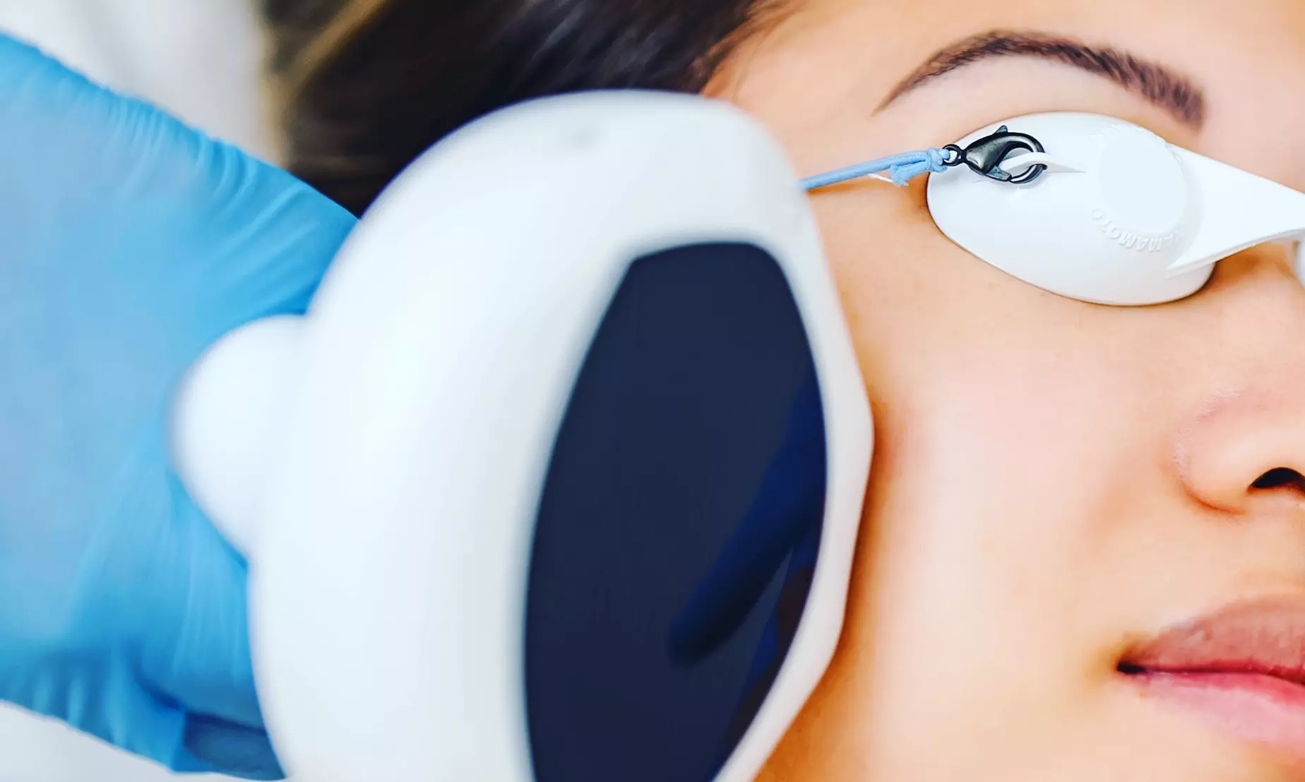 Up to 60% Off on IPL-Intense Pulse Light Therapy at Royal Day Spa