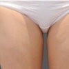 Image 3: Fat / Cellulite Reduction - Non-Branded at Dpz parlour