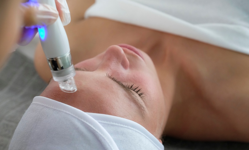 Image 4: Transform Your Skin with the Ultimate HydraFacial 6-in-1 Treatment