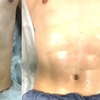 Image 3: Post-Op Lymphatic Massage at Post op curves(Up to 60% Off)