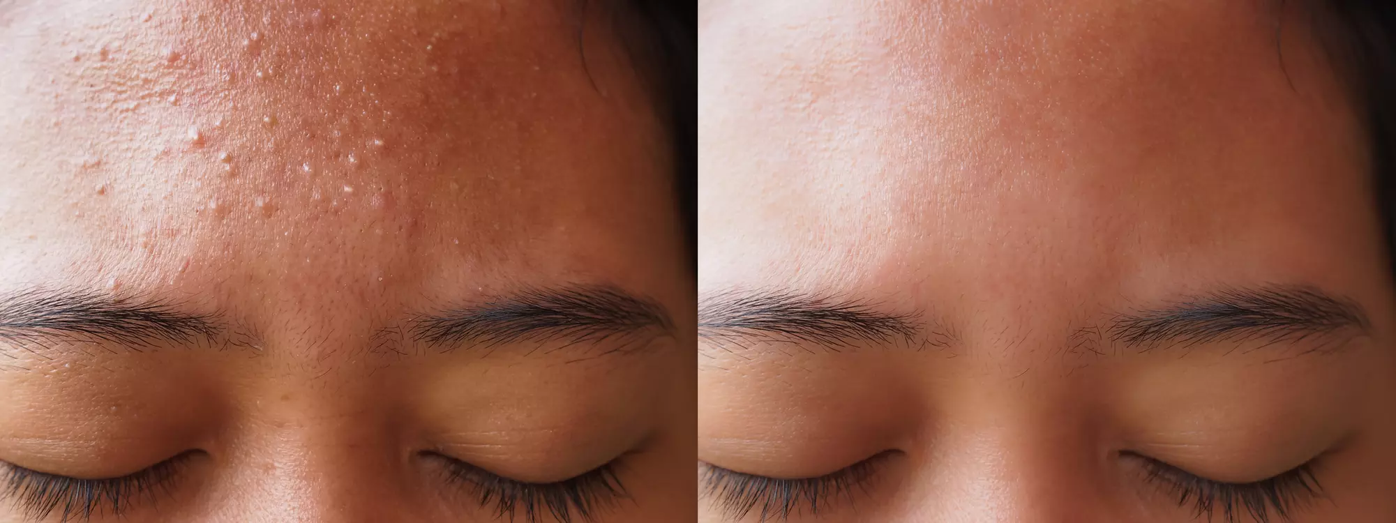 Up to 55% Off on Facial - Chosen by Customer at Viso Medi-Spa & Boutique