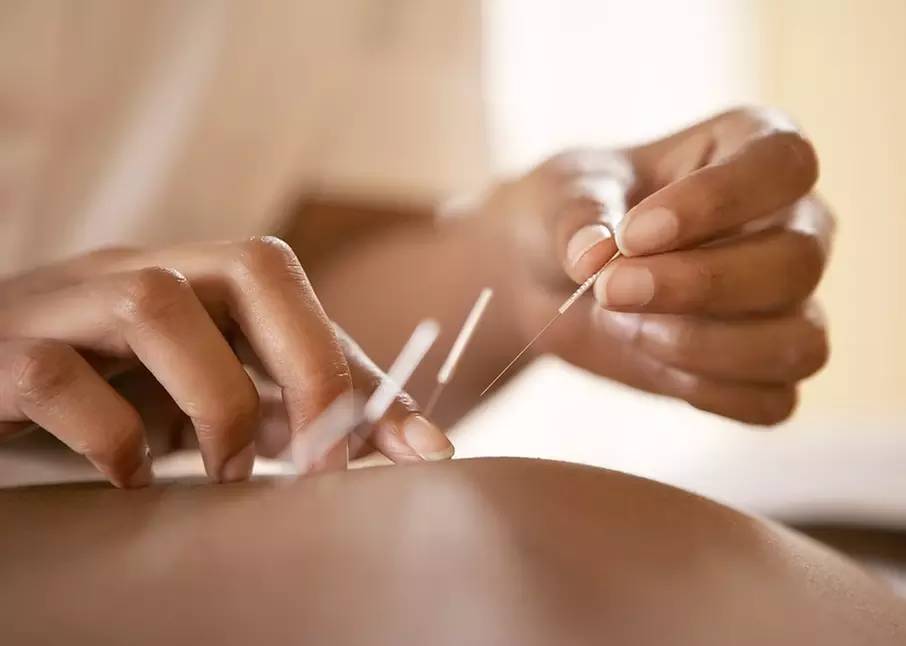 Relax with Traditional Chinese Massage/Acupuncture/Moxibustion Therapy