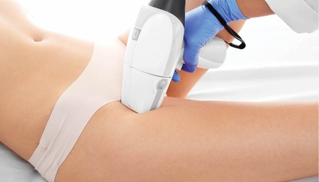 4 sedute di epilazione laser su inguine e ascelle o gambe al centro 3lashes Studio (sconto fino a 70%)