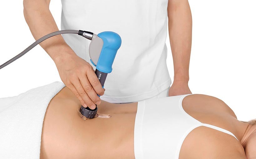 Experience Relief with One Shockwave Therapy Treatment at Tustin Chiropractic and Injury Clinic (Up to 51% Off) - Second Medium