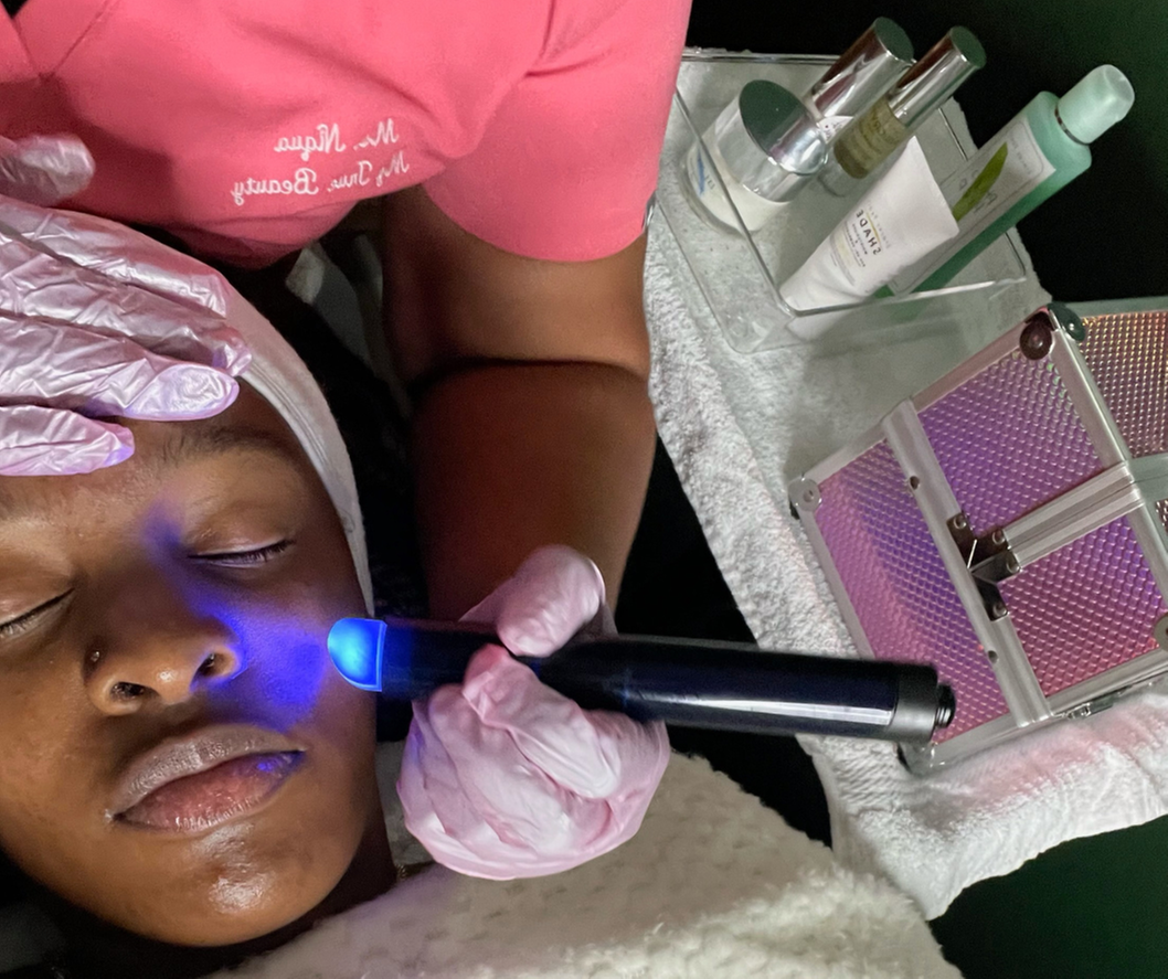 Up to 48% Off on Microdermabrasion at My True Beauty - Primary Image