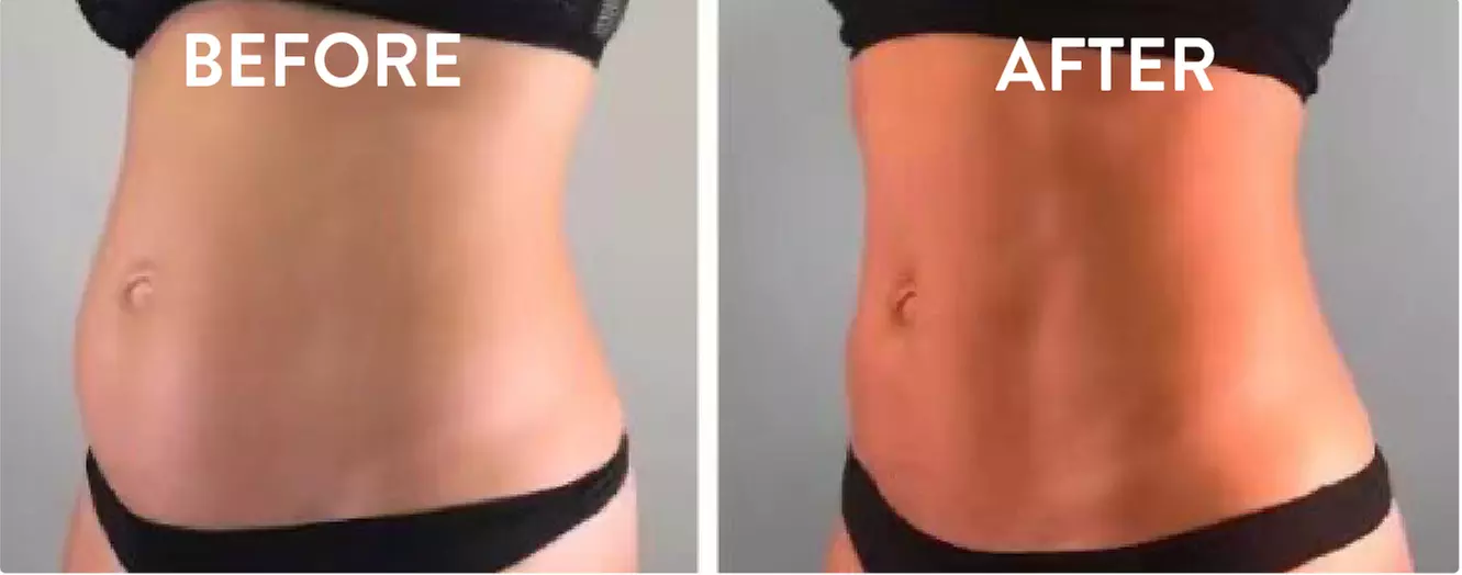 Revitalize Your Look with Cryo Face & Body Session