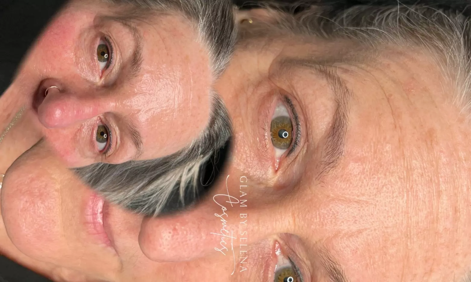 Non-Invasive Fibroblast Face Skin Tightening Treatment