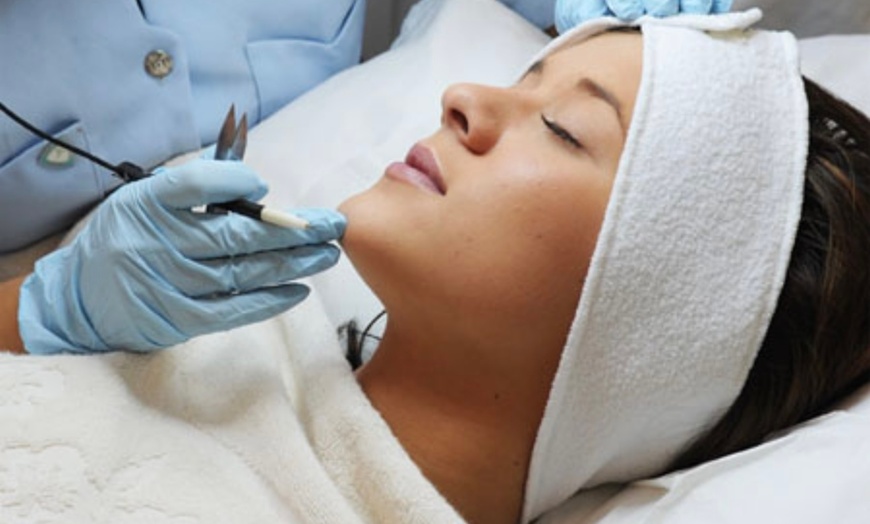 Image 1: Get Smooth Skin: Electrolysis Hair Removal Session