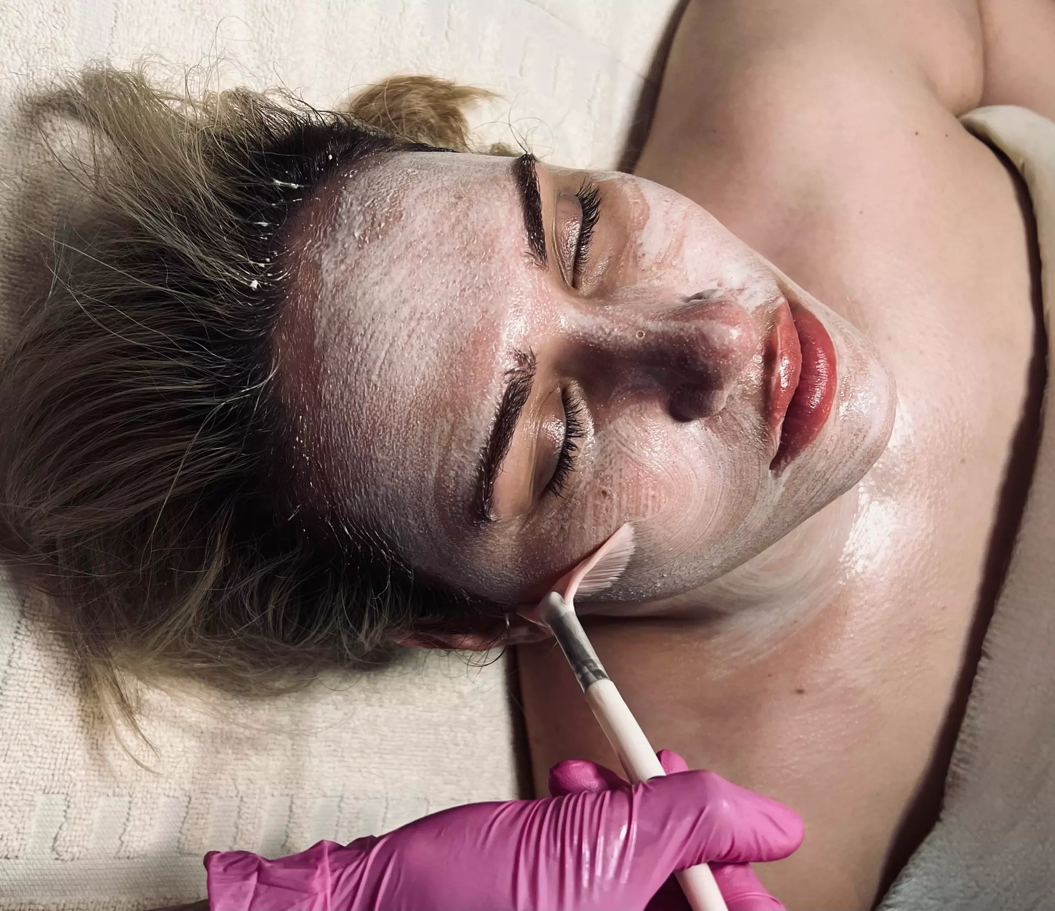 Up to 37% Off on Microdermabrasion at TruSkin Esthetics LLC - Primary Image