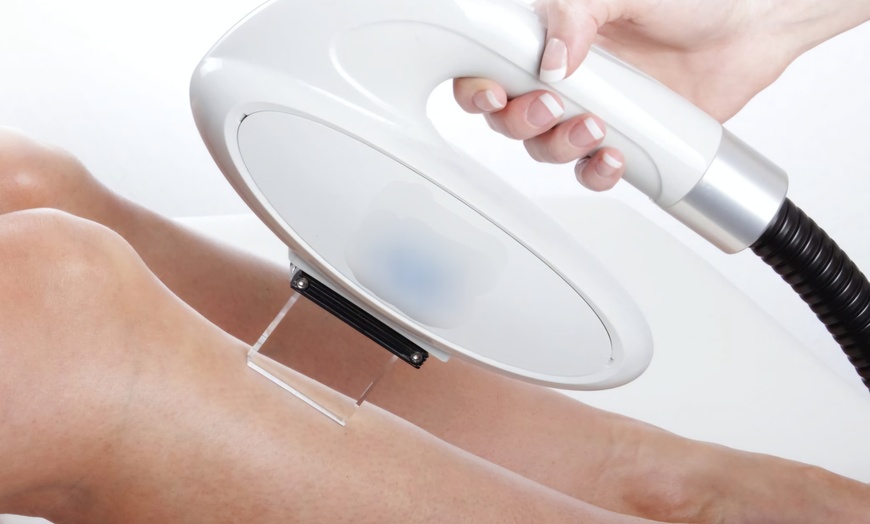 Image 1: 6 IPL hair removal Sessions: Small, Medium, Large, or Extra Large Area