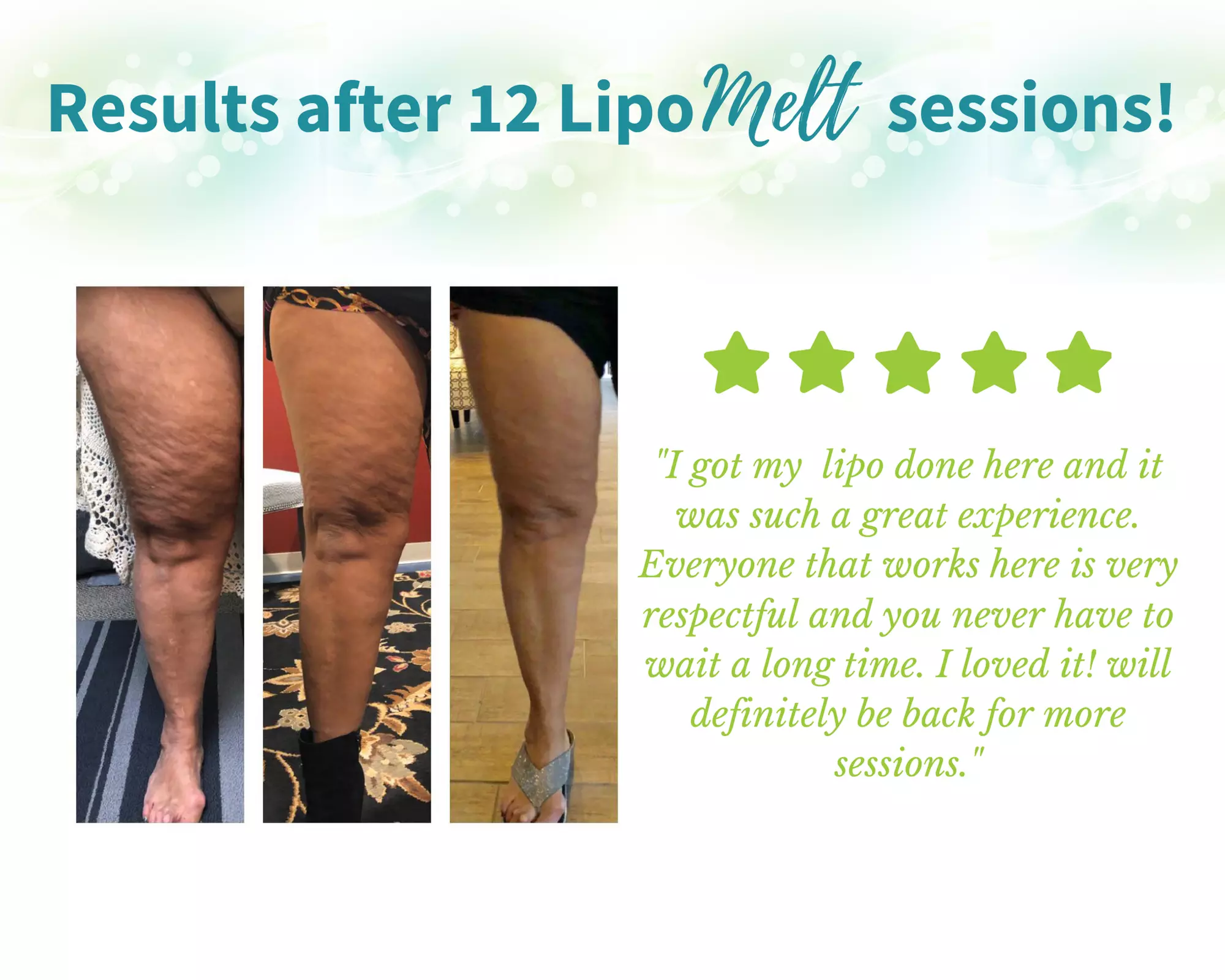 LipoMelt Sessions with 3D Fit Scan at Ideal Weight Loss of San Antonio (Up to 43% Off). Three Options Available. - Second Medium