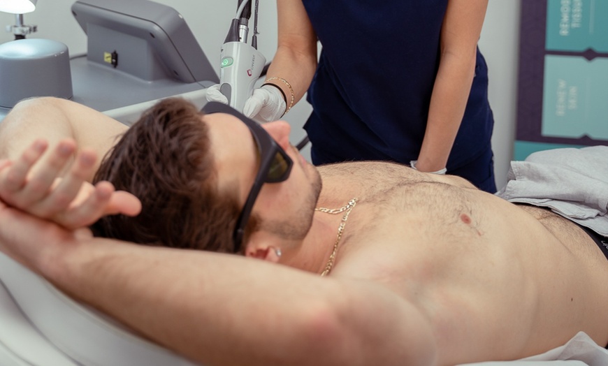 Image 7: Up to 73% Off on Laser Hair Removal at Hollywood Laser Med Spa