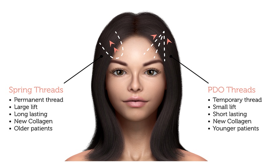 Image 6: Bella Hadid Style Eyebrow Lift With PDO Threads at No Pain All Gain Spa (Up to 30% Off)