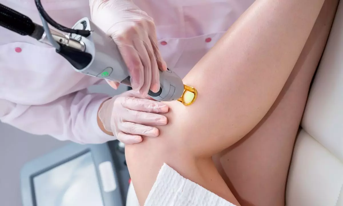 Up to 52% Off on SHR Laser Hair Removal at Alberta Laser Clinic - Second Medium