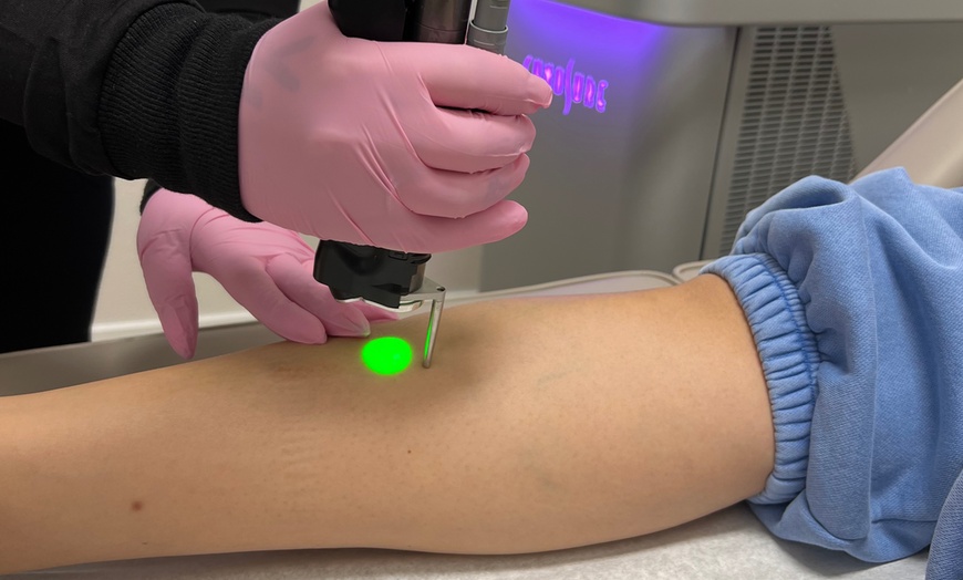 Image 3: Remove Unwanted Hair & Get Silky Smooth Skin w/ One Laser Hair Removal