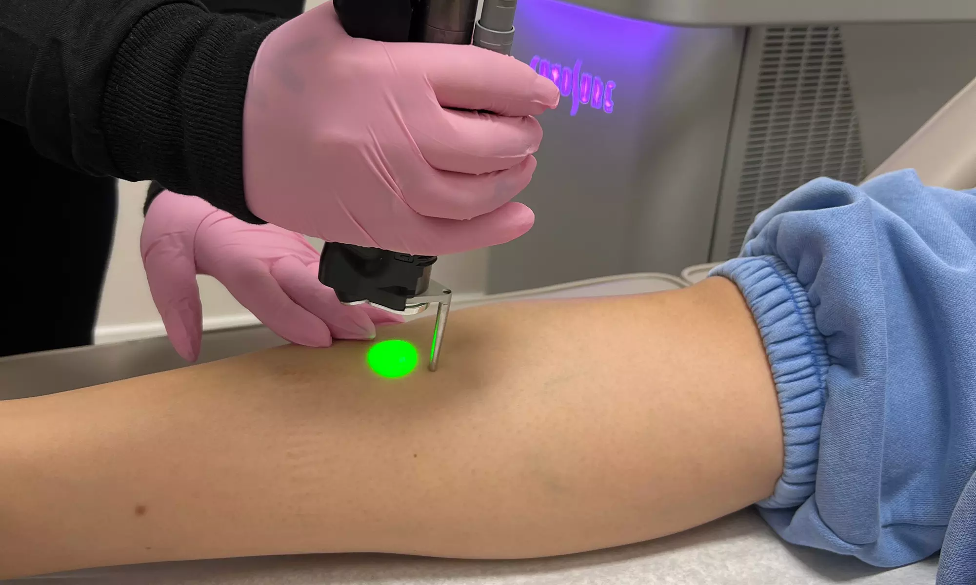 Remove Unwanted Hair & Get Smooth Skin w/ One Laser Hair Removal Session at Laser Skin Lounge (Get 71% Off) - Second Medium