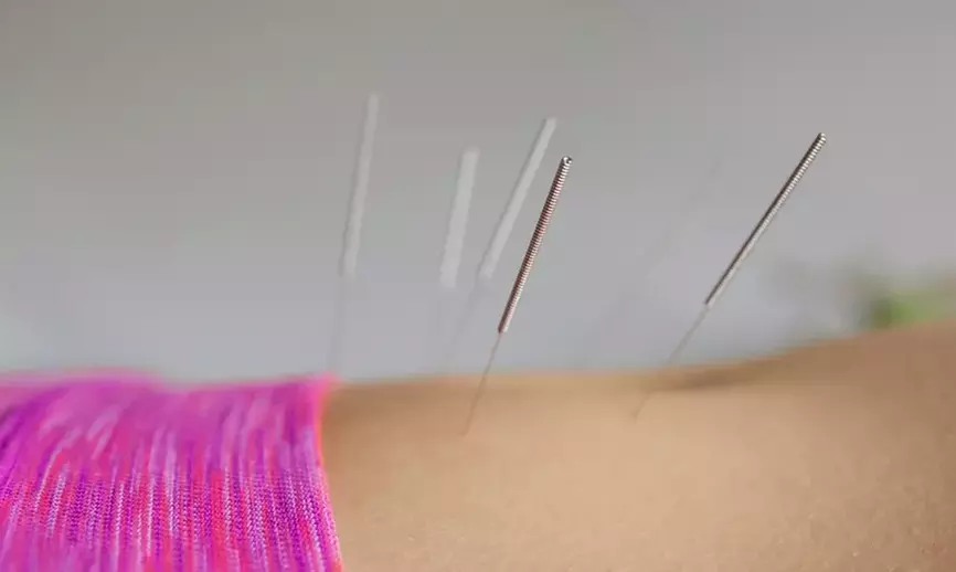 Up to 50% Off on Acupuncture at Pink Heart Acupuncture & More - Primary Image