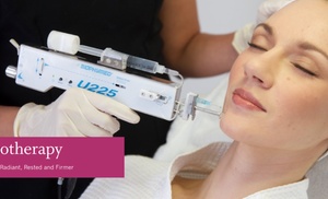 Micro-Needling