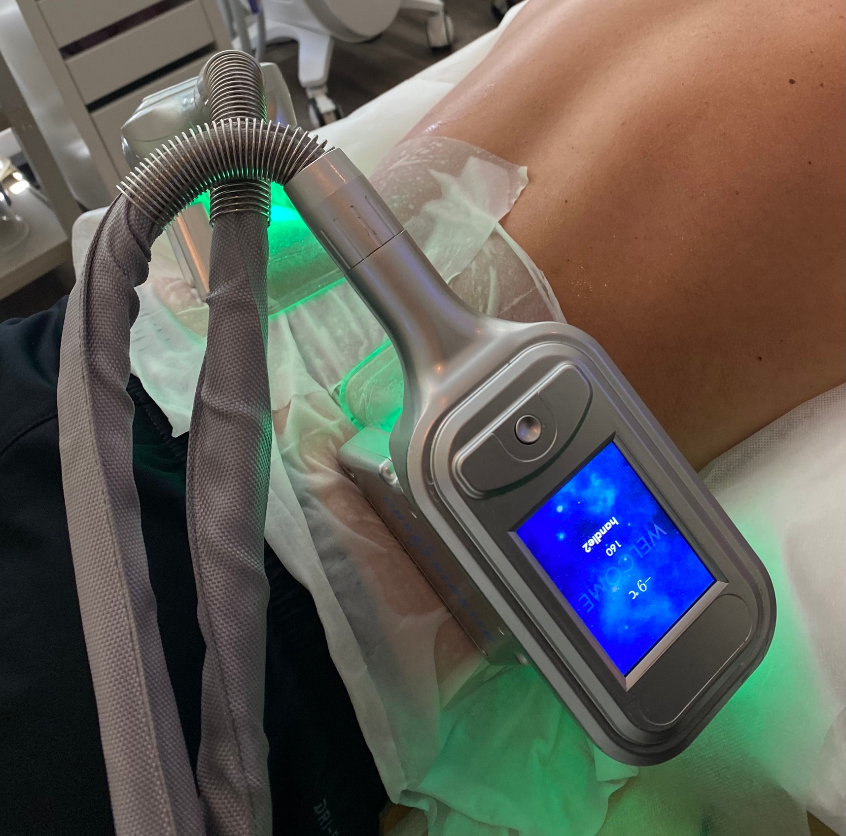 Cryoslim Treatment Options for Targeted Fat Reduction