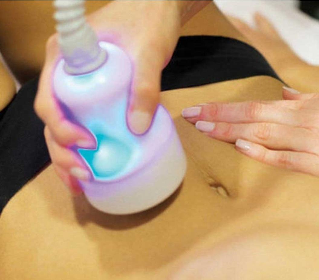 Cryo Slimming & Cryo Toning: Fat Reduction and Skin Rejuvenation