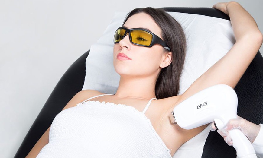 Image 2: Up to 84% Off on Laser Hair Removal at UK Aesthetics Lounge