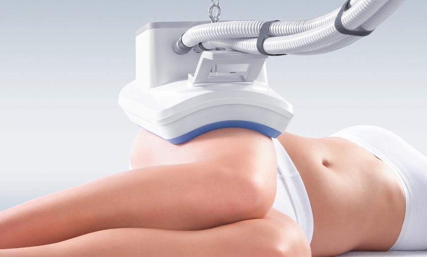 Image 2: Lokalisierte Kryotherapie-Sitzungen an 1 oder 3 Zonen inkl. Beratung