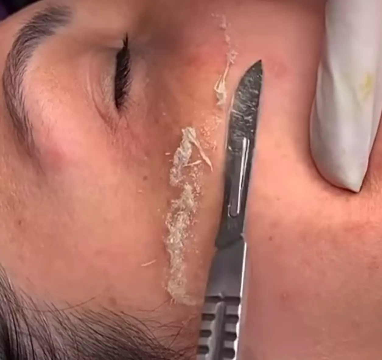 Up to 37% Off on Facial at Lara skincare and beauty - Primary Image