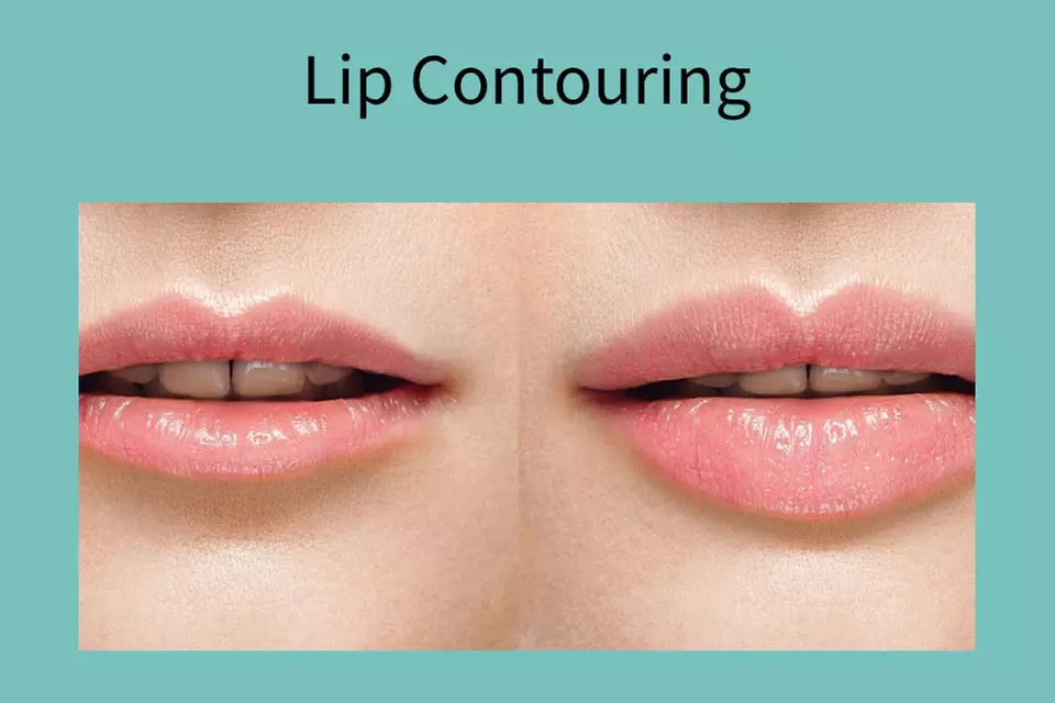 Up to 50% Off on Lip Contouring at Marie Jé Aesthetics - Primary Image