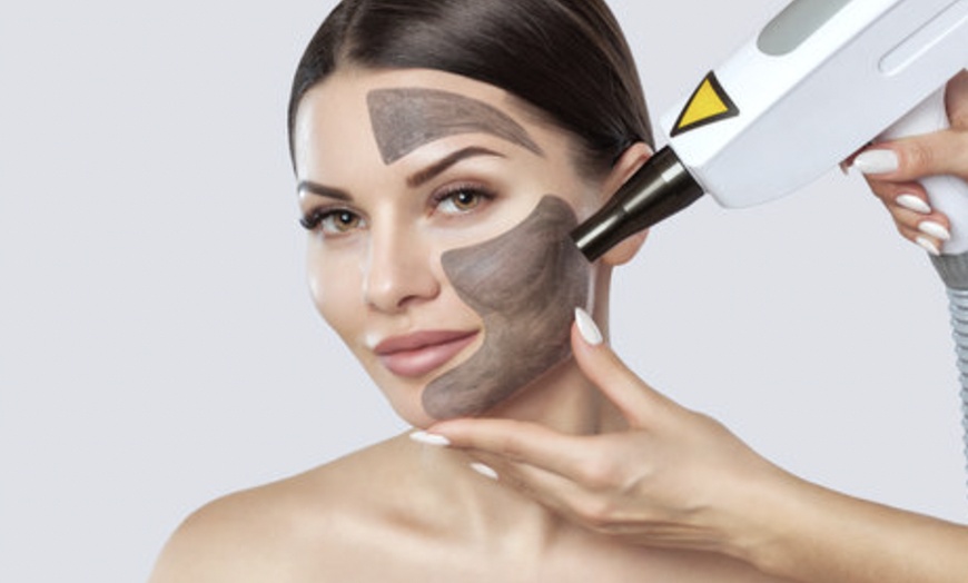 Image 1: Six Sessions of Carbon Laser Peel Facial / Hollywood Peel 