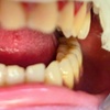 Image 3: Teeth Whitening Branded at Your Covina Family Dentistry