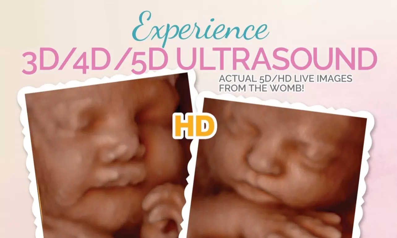 Up to 80% Off on Ultrasound - 3D / 4D at La Vita Bella North DFW - Primary Image