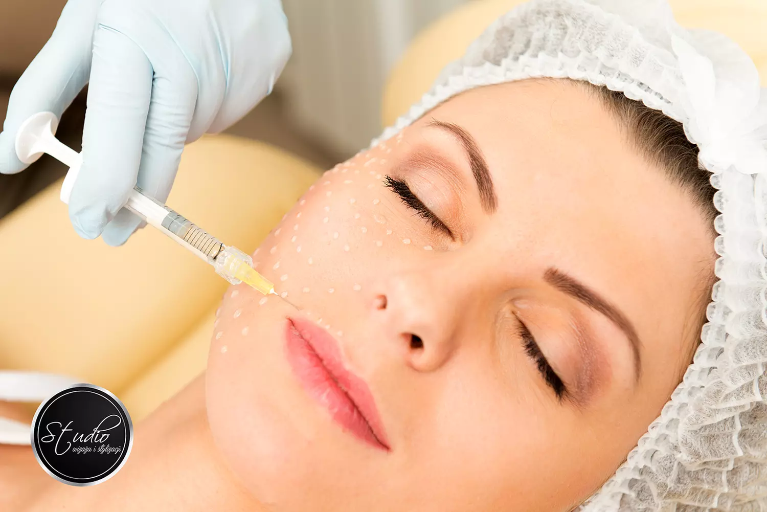 Mezoterapia igłowa skóry głowy w Studio Wizażu i Stylizacji w Rzeszowie