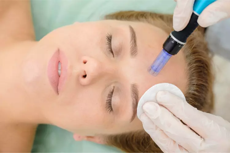 Up to 46% Off on Micro-Needling at Posh Beaute Boutique - Primary Image