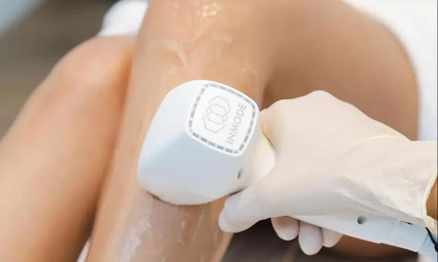 Up to 45% Off on Laser Hair Removal at Zen Med Spa - Primary Image