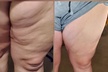 Up to 33% Off on Fat Reduction - Non-Branded at Couture Salon Parlor llc - Second Medium