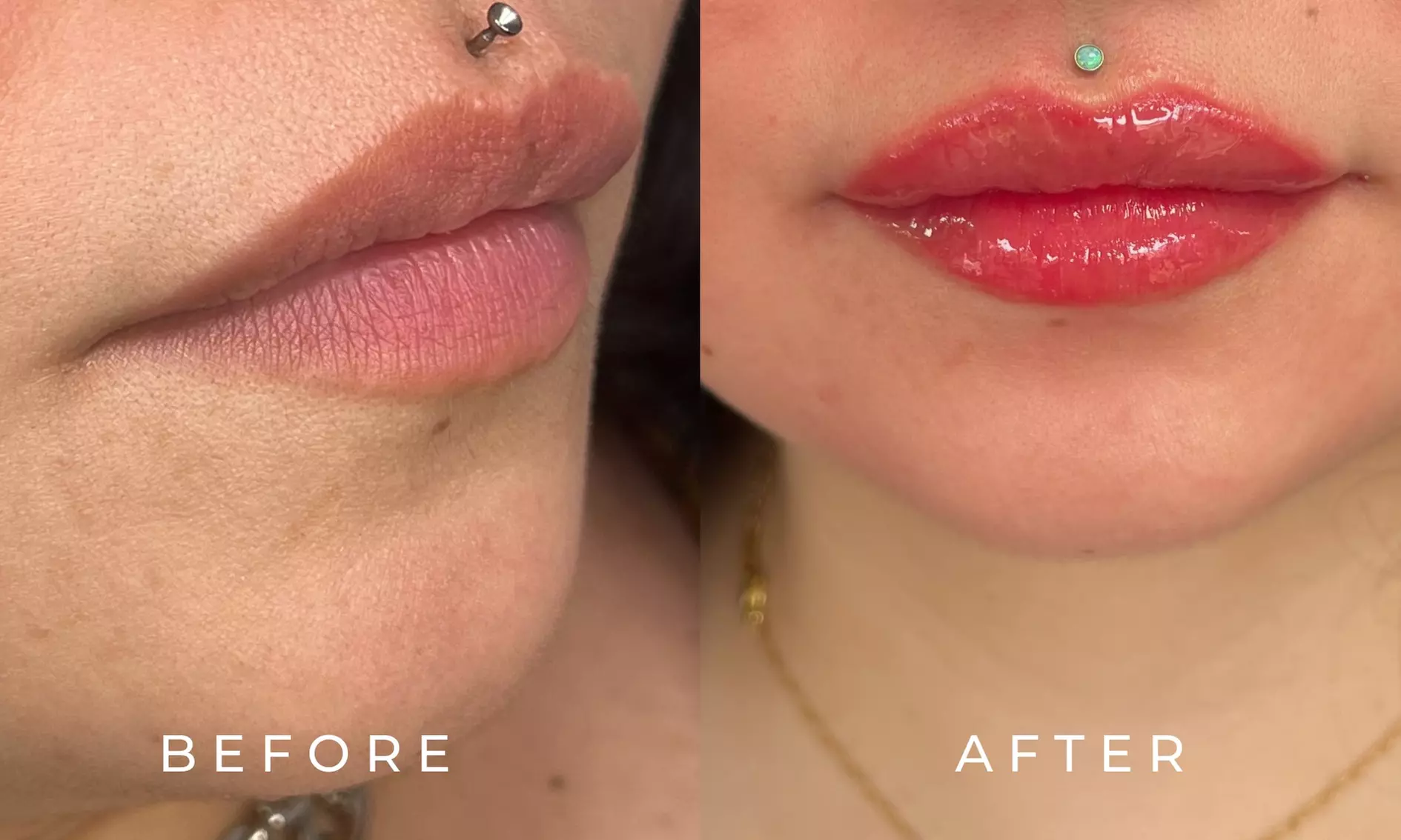 Tattooing at Cherry Ink - Second Medium