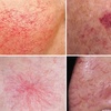 Image 1: Refresh Your Skin With a 30 Min Session or Get a Follow-Up
