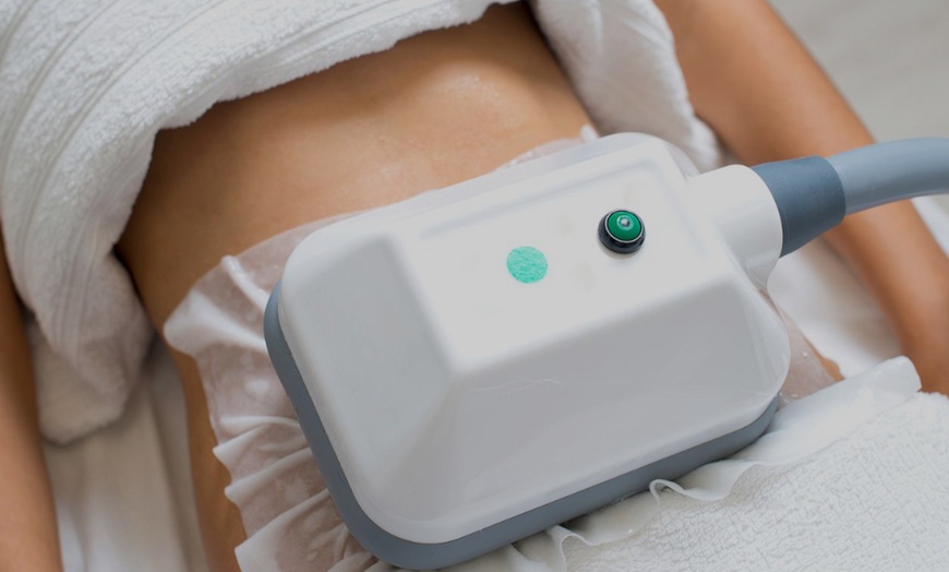 Image 1: Fat Reduction Treatment for UnderChin, Abdomen, or Inner Thigh 