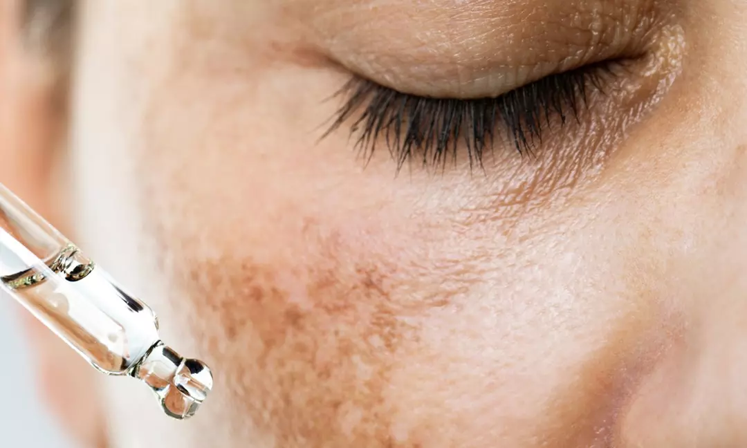 Up to 43% Off on  at Simcoe Cosmetic Clinic - Primary Image
