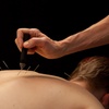 Image 2: Up to 30% Off Acupuncture - Tailored Sessions with Award-Winning L.Ac
