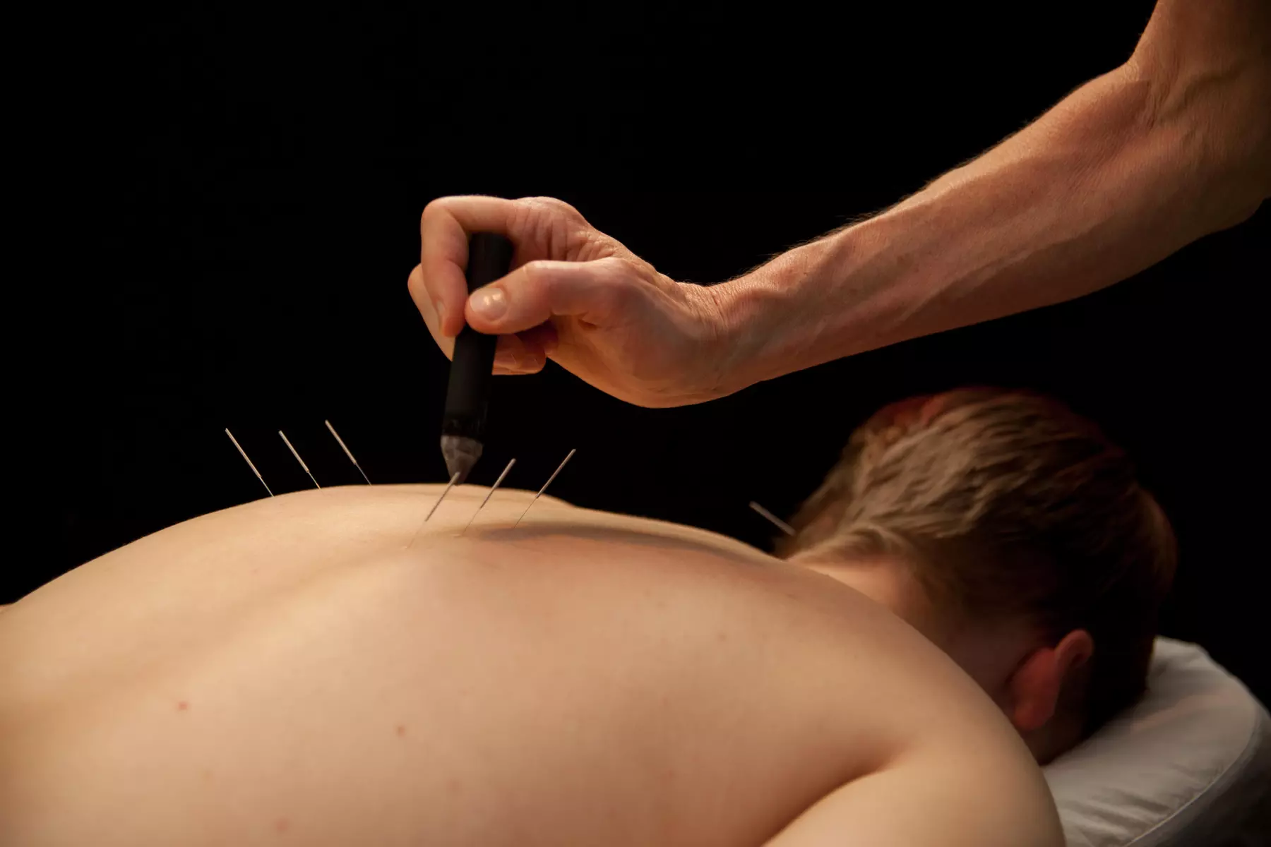 Up to 30% Off Acupuncture - Tailored Sessions with Award-Winning L.Ac
