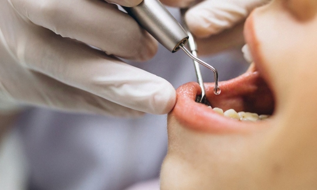 Limpieza bucal con ultrasonido, pulido, revisión y diagnóstico