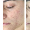 Image 3: Up to 55% Off on Facial - Chosen by Customer at Rise Skin Spa