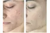 Up to 51% Off on Facial - Chosen by Customer at Rise Skin Spa