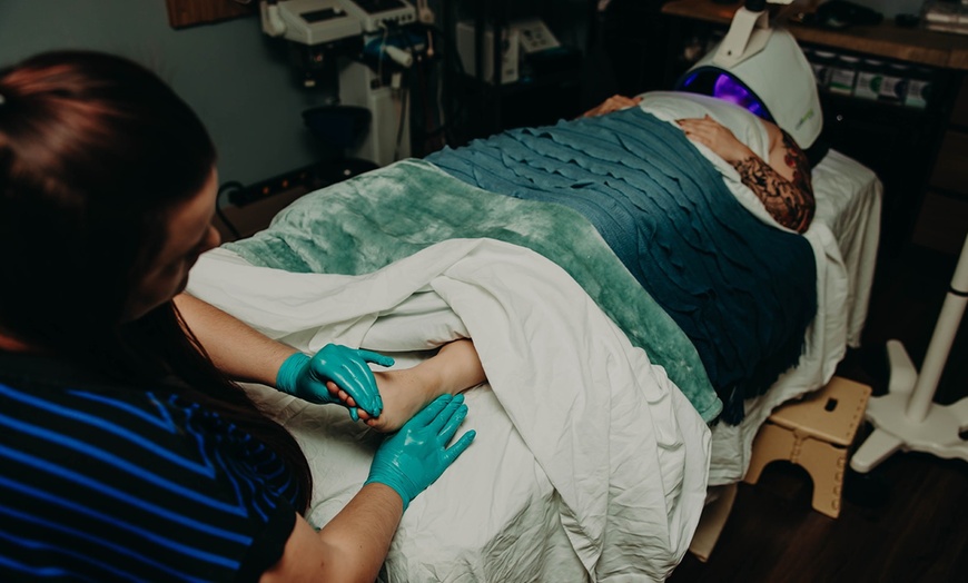 Image 3: Up to 35% Off on Micro-Needling at Panda Pampering