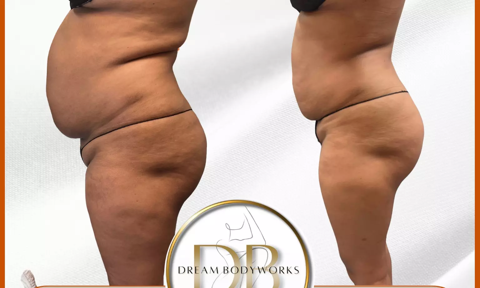 Up to 53% Off on Lymphatic Drainage Massage at Dream Bodyworks Llc